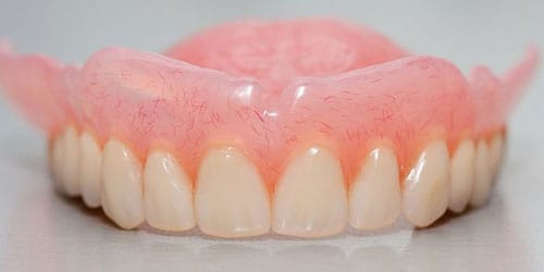 для чего используются зубные протезы